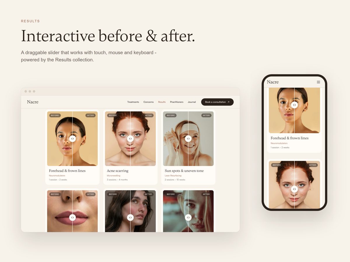 Results page with the before-and-after slider